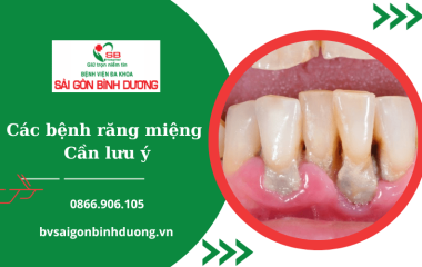 Một số bệnh về răng miệng thường gặp cần đặc biệt lưu ý