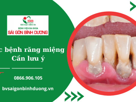 Một số bệnh về răng miệng thường gặp cần đặc biệt lưu ý