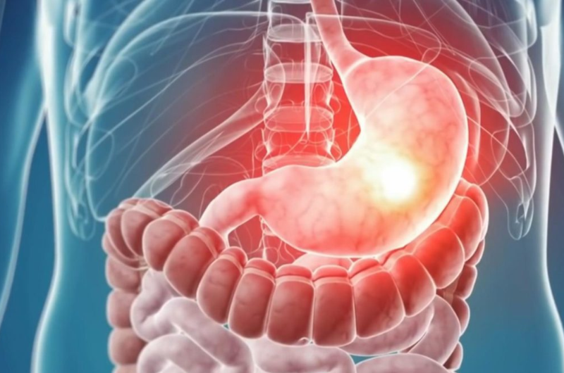 Nội soi tiêu hóa phương pháp tầm soát ung thư sớm đường tiêu hóa