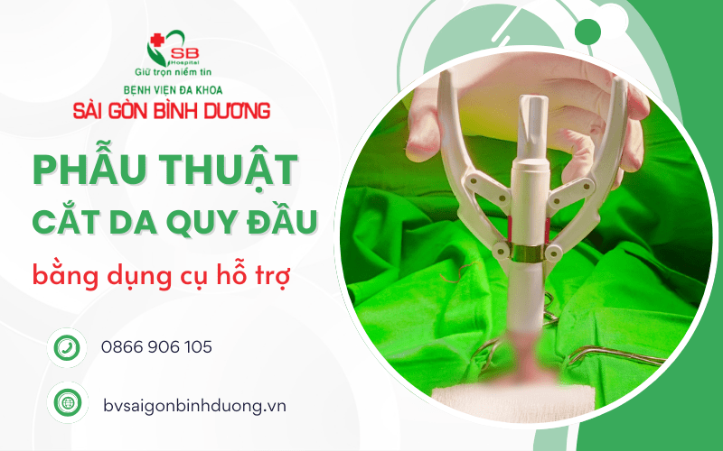 cắt da quy đầu