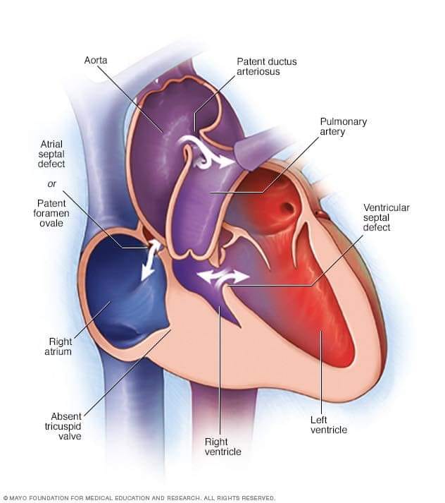 VG trong siêu âm tim là gì? Tìm hiểu vai trò và ý nghĩa của chỉ số VG